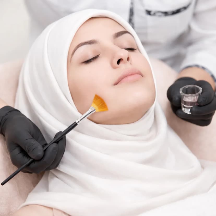 التقشير البارد